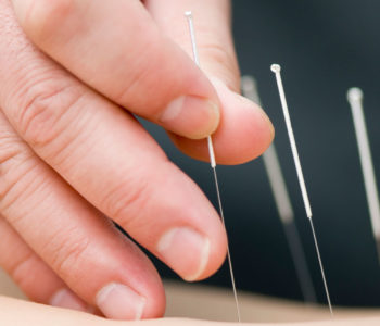 Picture of Acupuncture Needle